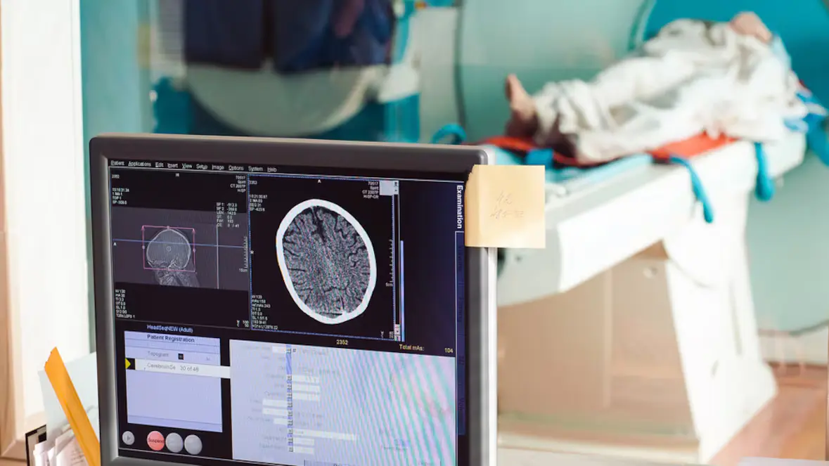 Albertans can pay for MRIs and other tests without a doctor's referral, as of Friday
